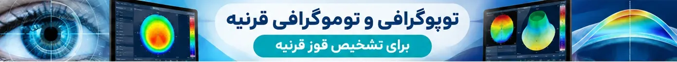 توپوگرافی و توموگرافی قرنیه برای تشخیص قوز قرنیه