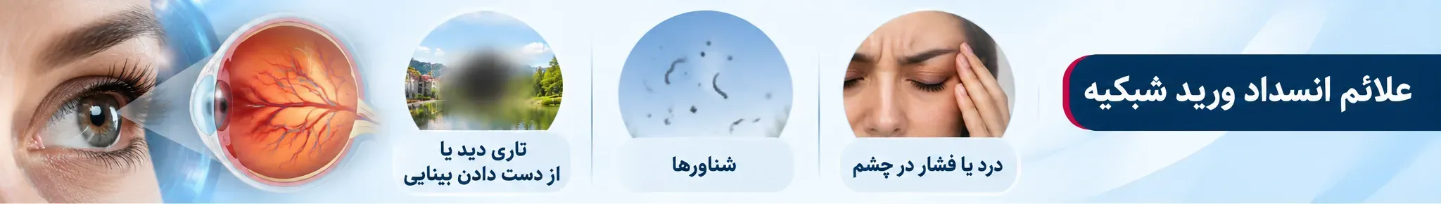 علایٔم انسداد شبکیه
