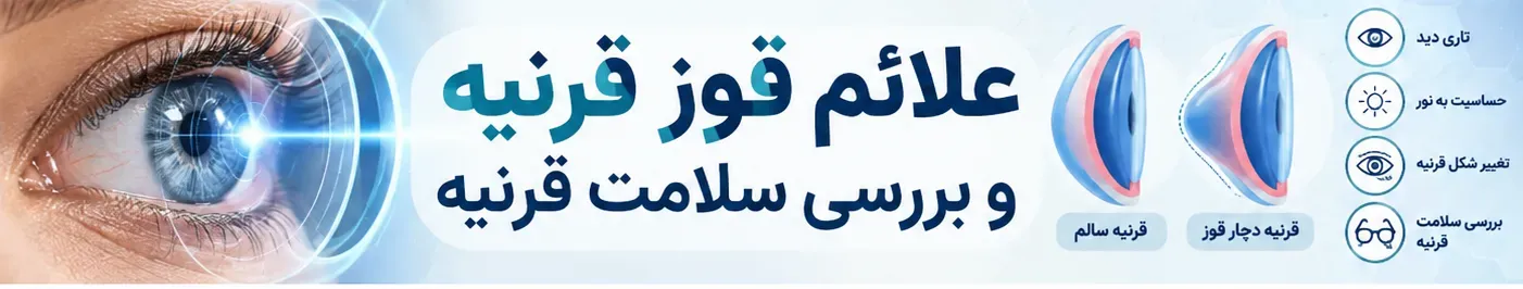 علائم قوز قرنیه و بررسی سلامت قرنیه