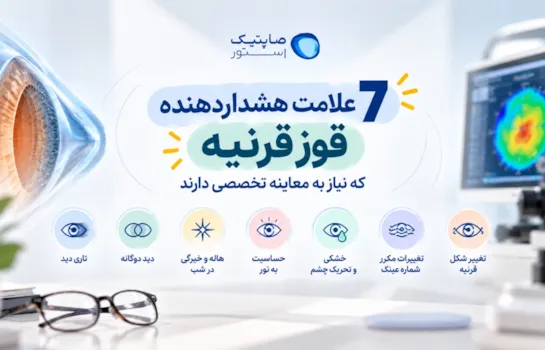 7 علامت هشداردهنده قوز قرنیه که نیاز به معاینه تخصصی دارند