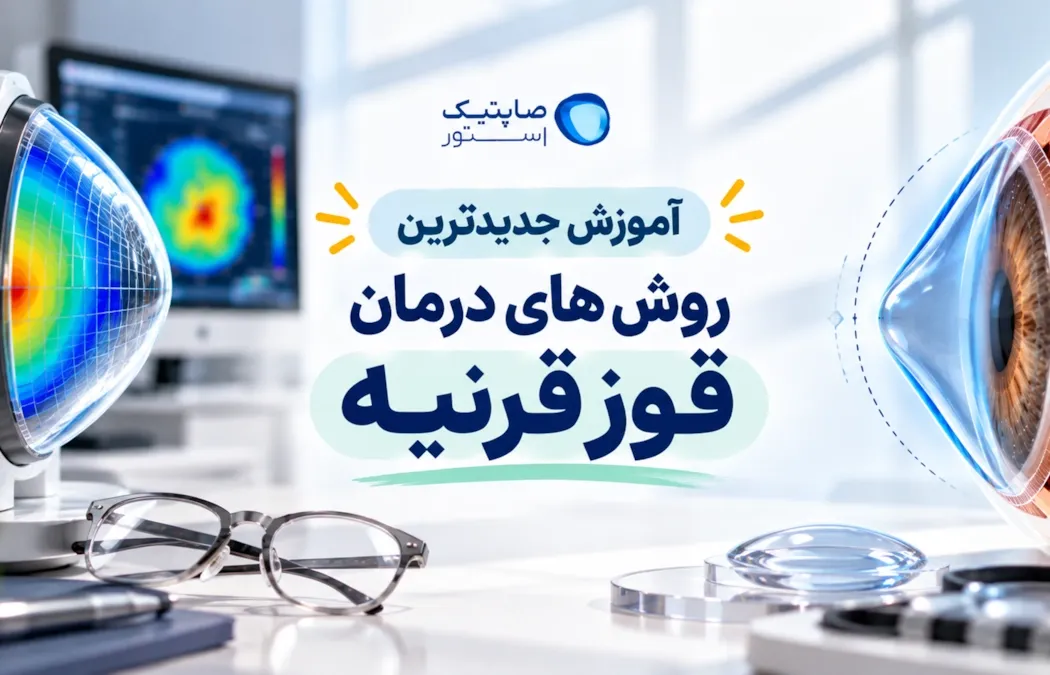 آموزش جدیدترین روش های درمان قوز قرنیه