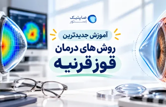 آموزش جدیدترین روش های درمان قوز قرنیه