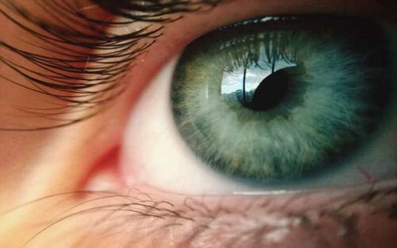 روش درمان آستیگماتیسم چشم